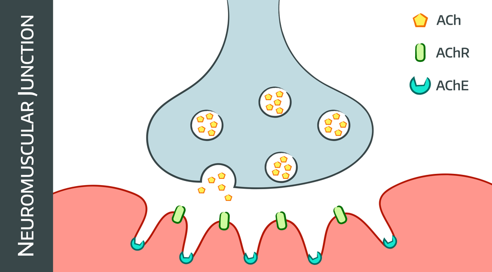 Myasthenia Gravis